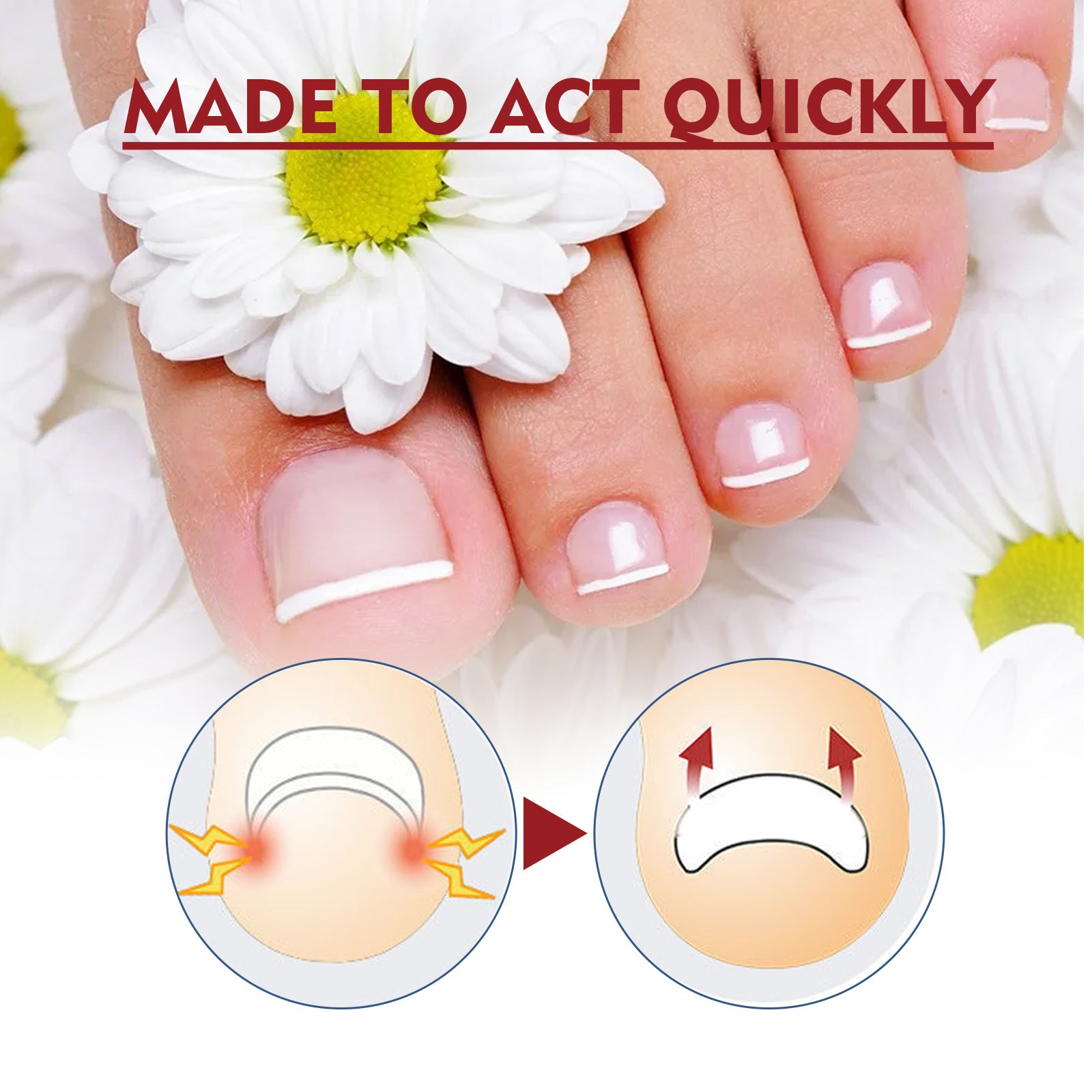 Jaysuing Anti-Inflammatory Nail Care Oil for Thick Nails