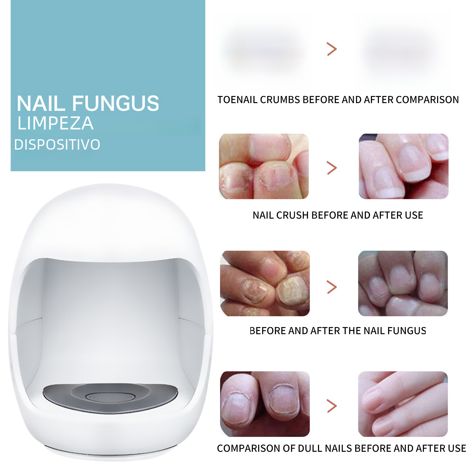 South Moon Nail Care Device for Thickened and Bright Nails