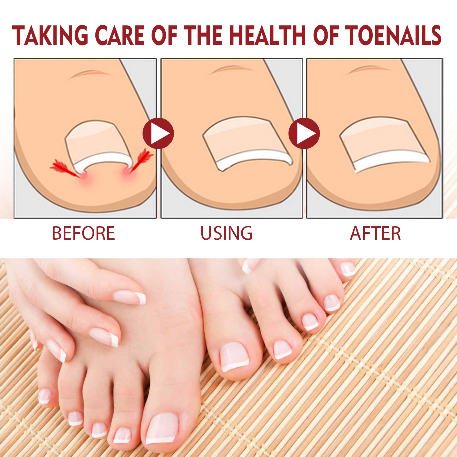 Jaysuing Anti-Inflammatory Nail Care Oil for Thick Nails